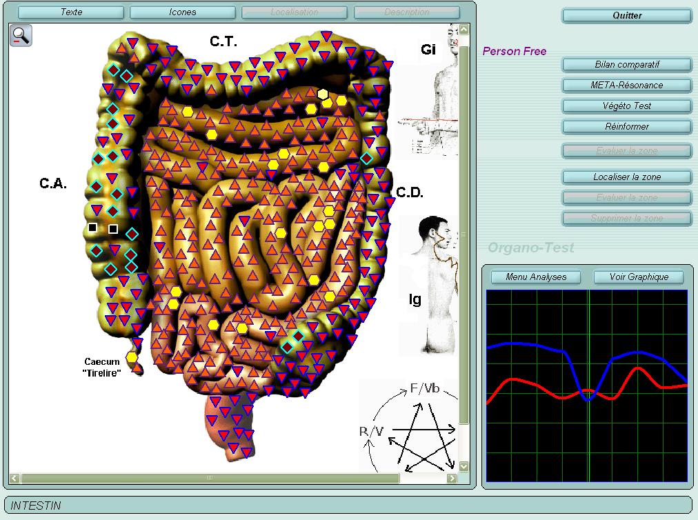 Capture d'écran illustrative du logiciel Physioscan